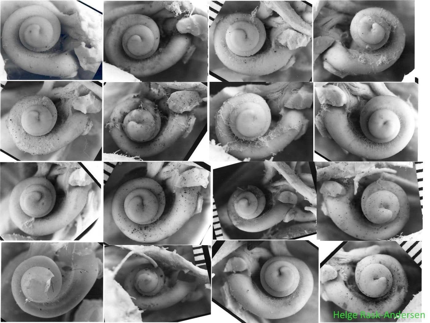 Cochlea images