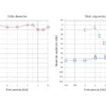 Audiograma preoperatorio