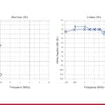 Patientenfall: Einseitige Ertaubung