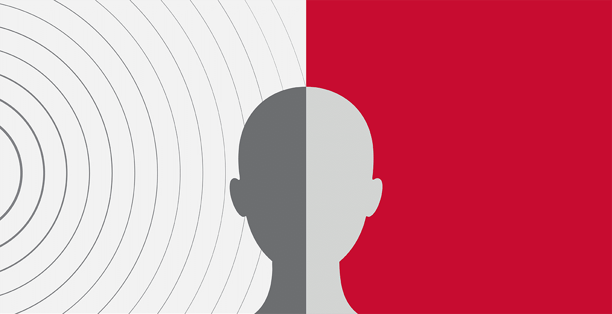 Single Sided Deafness